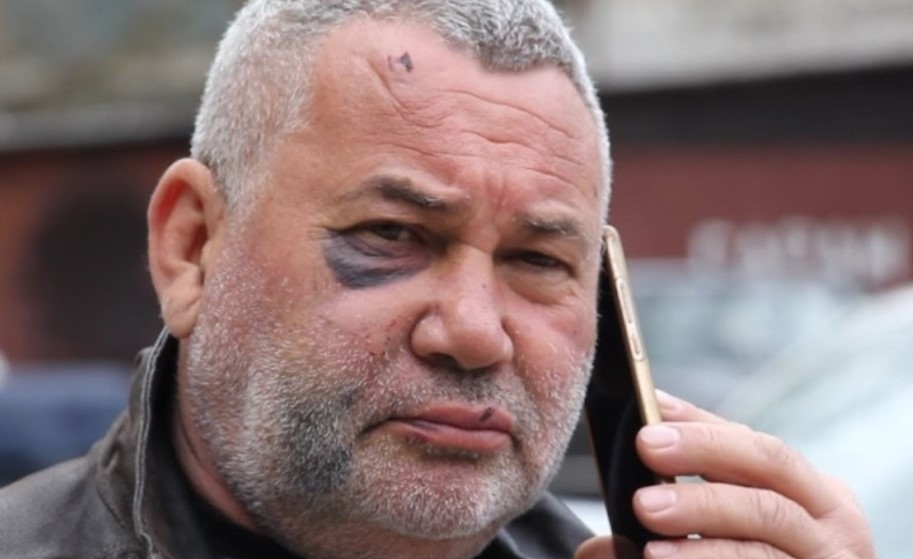 Докъде е стигнало разследването на побоя над кмета на село